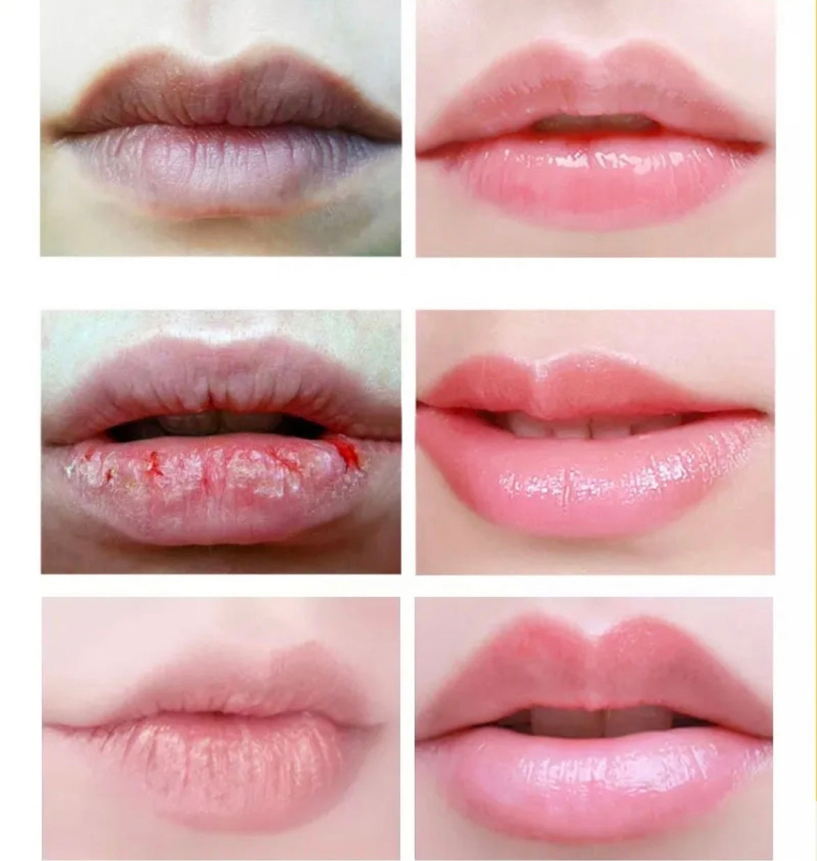 1. Lippenbalsam Rosenduft